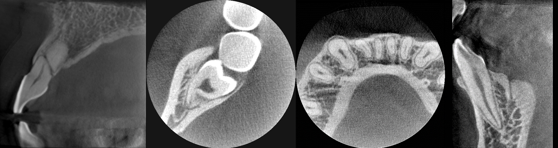 우수한 영상 처리 기술